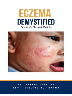 cover image of Eczema Demystified